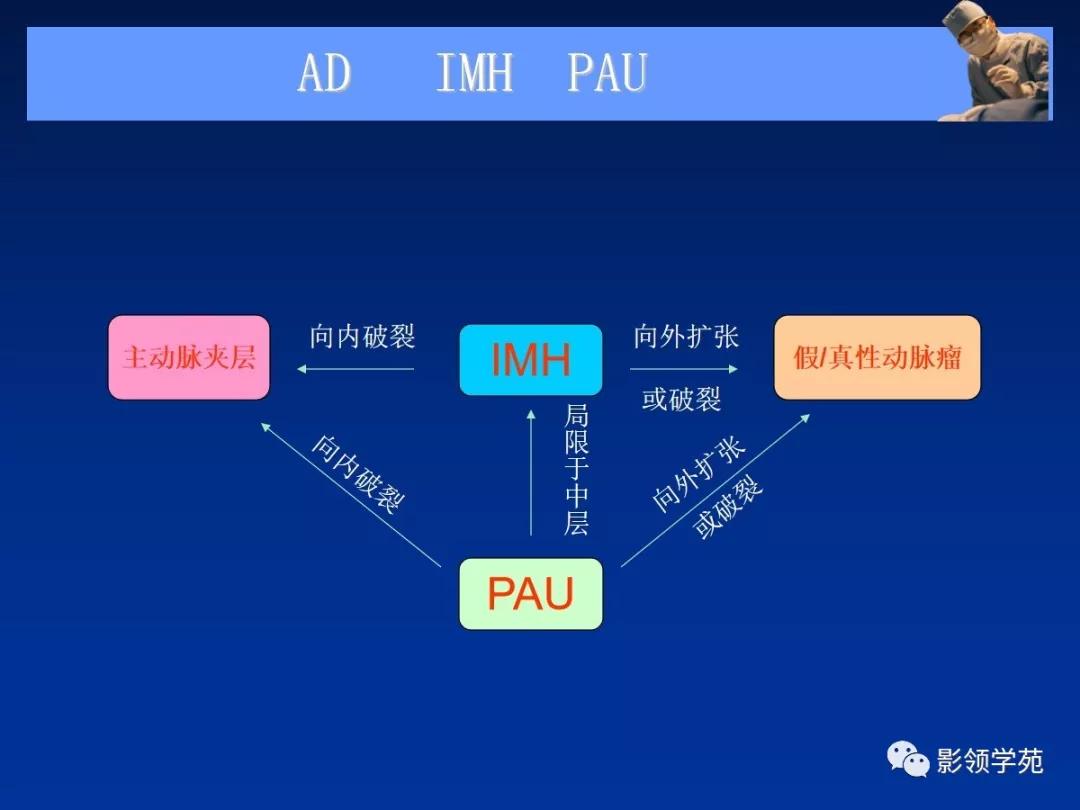 主动脉夹层壁间血肿如何鉴别,主动脉夹层血肿溃疡