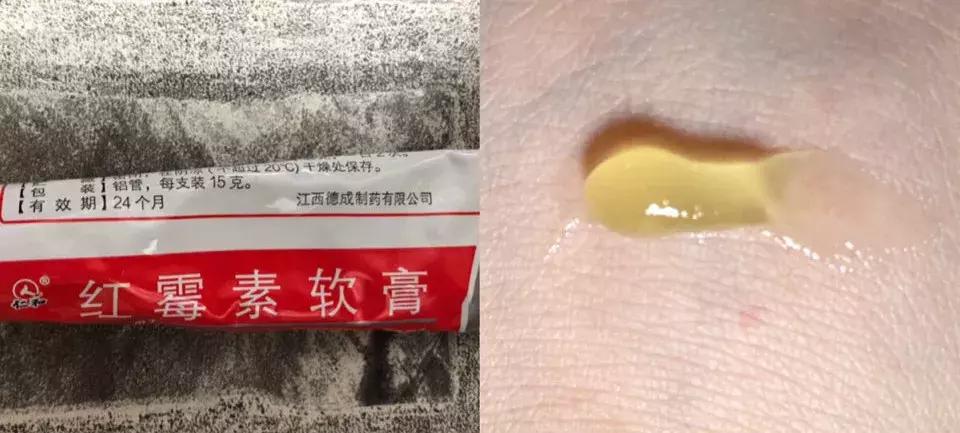 3块钱去黑头粉刺收缩毛孔正品,祛痘去黑头有什么药膏推荐