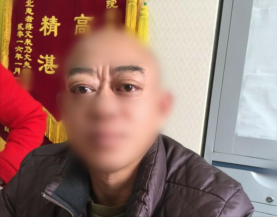 甲亢感觉眼睛有一点点突算严重吗,甲亢从刚突眼到严重需要多长时间