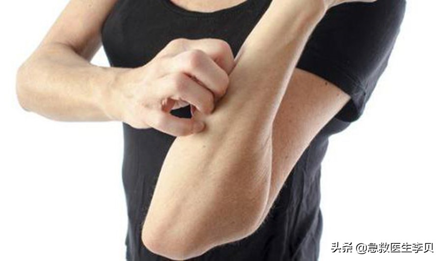 泡澡热射病,泡温泉会得热射病吗