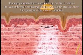 “小脸梦”光靠护肤品怎么够?美容仪才是留住青春的神助攻