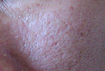 美容仪是智商税还是真的有效果,美容仪是智商税吗值得购买吗