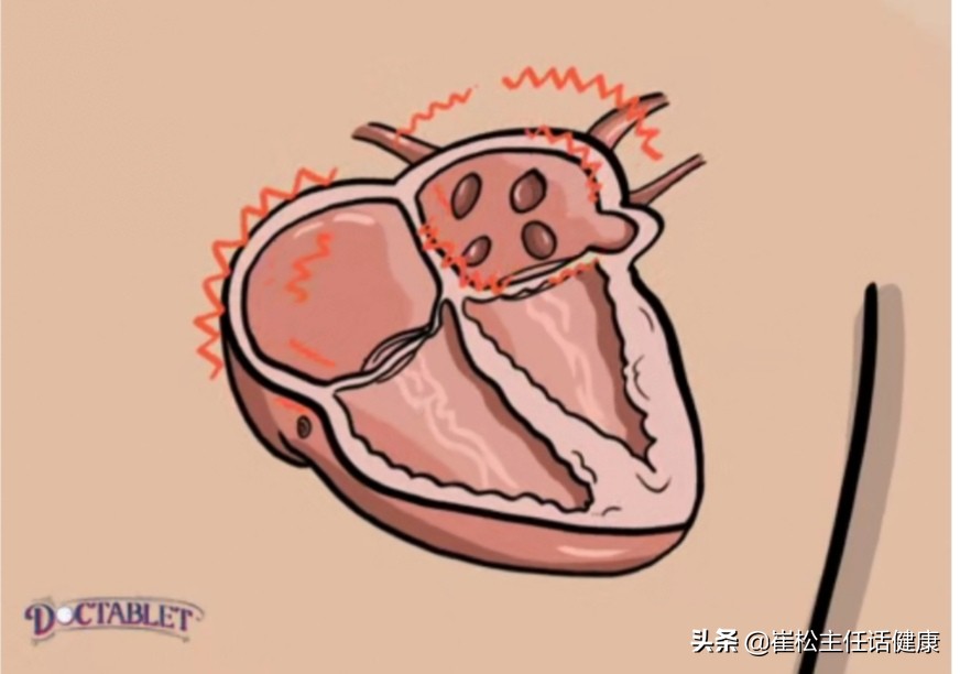 不想去医院第二弹！胸部不适的自我诊察