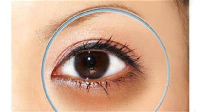 熊猫眼症如何治疗,熊猫眼正常提示什么