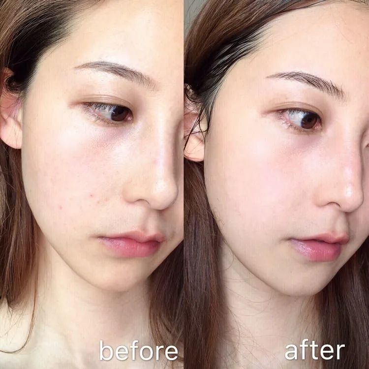 超补水超好用的芦荟胶,如果补水保湿只用芦荟胶可以吗