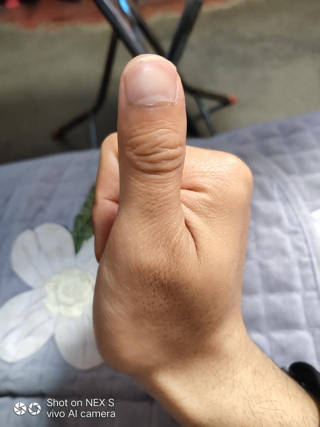 自觉心里不舒服是焦虑症吗,焦虑症总是自觉身体不适