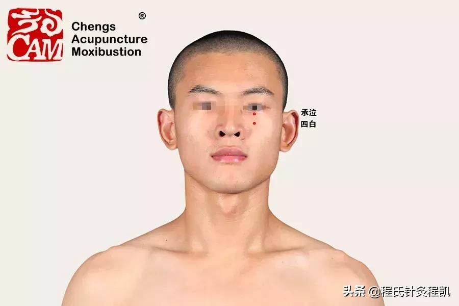 老年黄斑变性中医最新诊治思路,国医大师治黄斑变性医案