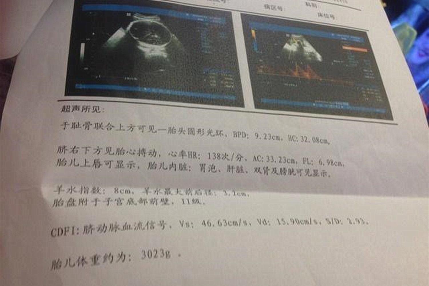 40岁孕妇妊娠43周胎儿仍不出来，去医院检查，医生痛批：糊涂