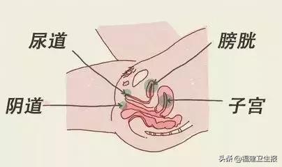 福建女子度完蜜月后出现尿频尿急,竟是患上这病!国庆刚结婚的要注意了!