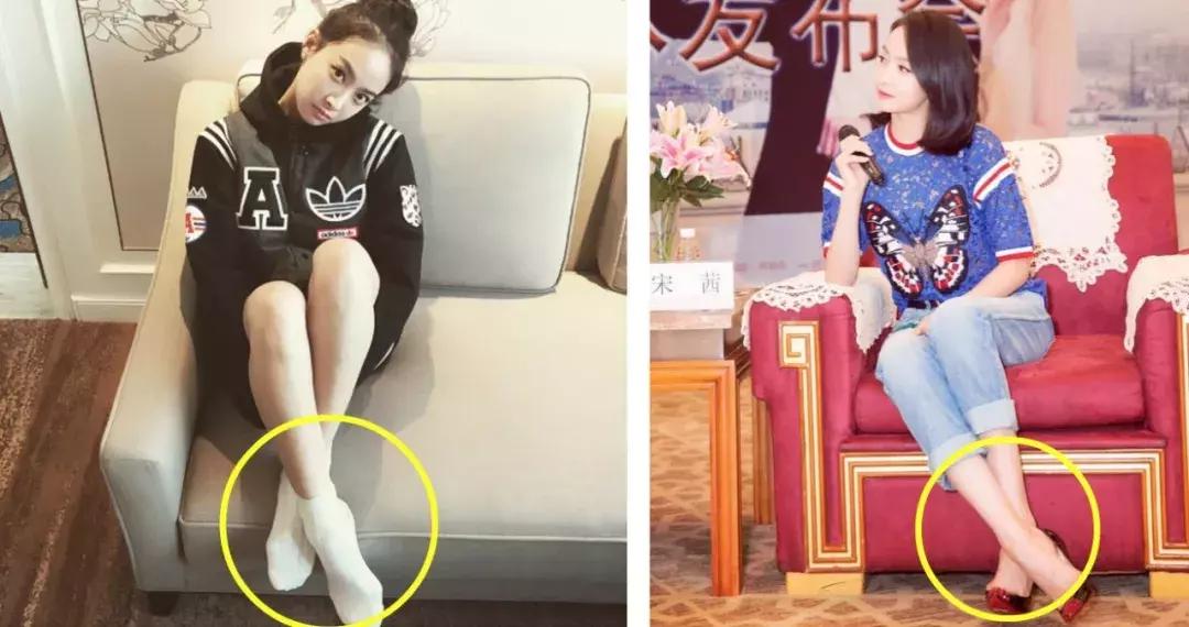 脚拇外翻怎么办教你一招,你的脚好丑的意思