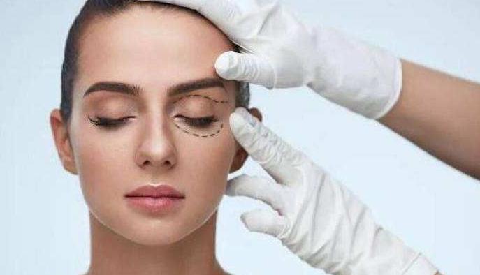 南华博士双眼皮,南华博士割双眼皮