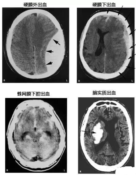 完整版神经系统医学美图看一眼就可以记住