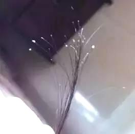 掉下的头发根部有小白点怎么办,掉的头发发根有小白粒是怎么回事
