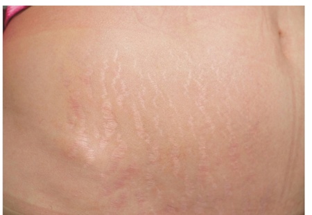 辣妈快速瘦肚子法,辣妈瘦肚腩的最快方法三个动作