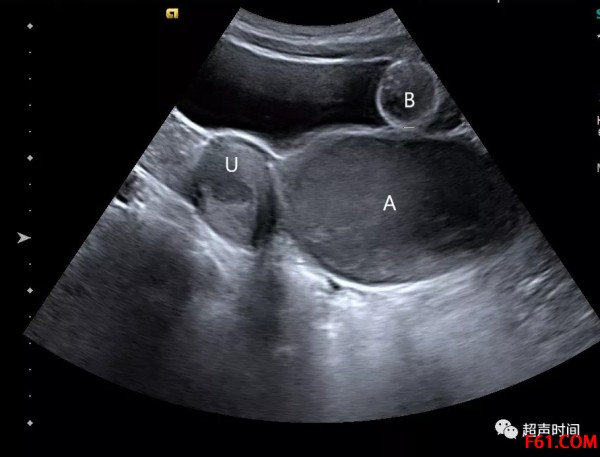 典型处女座高冷文案,典型处女座特征