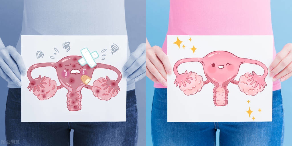 子宫腺肌病介入栓塞治疗能否治好,辽宁省内医院子宫腺肌症介入栓塞