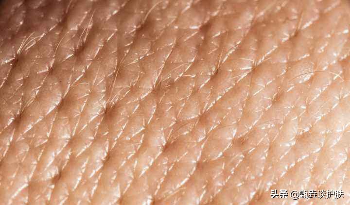 干皮起皮用什么粉底比较好,上粉底卡粉起皮