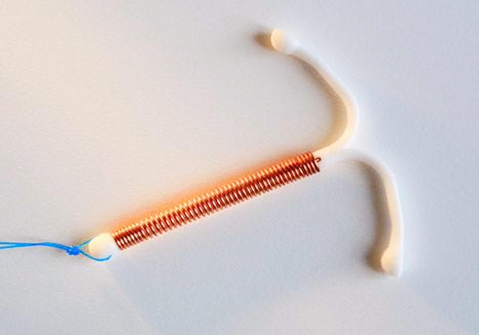 上环妈妈取环,几十年前女性上环