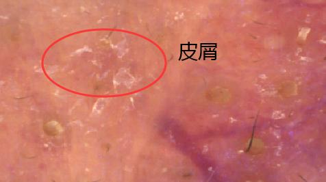 口碑最好的男士控油祛痘洗面奶,口碑最好十大洗面奶适用敏感肌