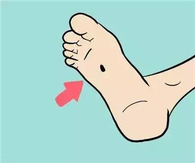 黑痣要去掉吗?专家和你聊聊关于“黑痣”的那些事儿