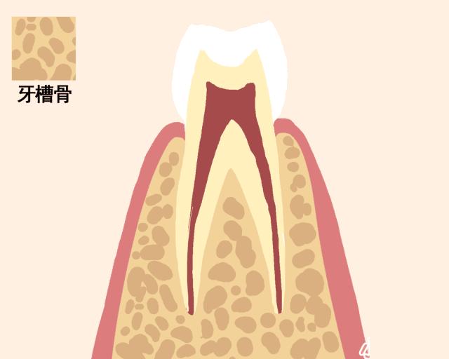 牙齿缺失10年倾斜脱落图,一张动图告诉你