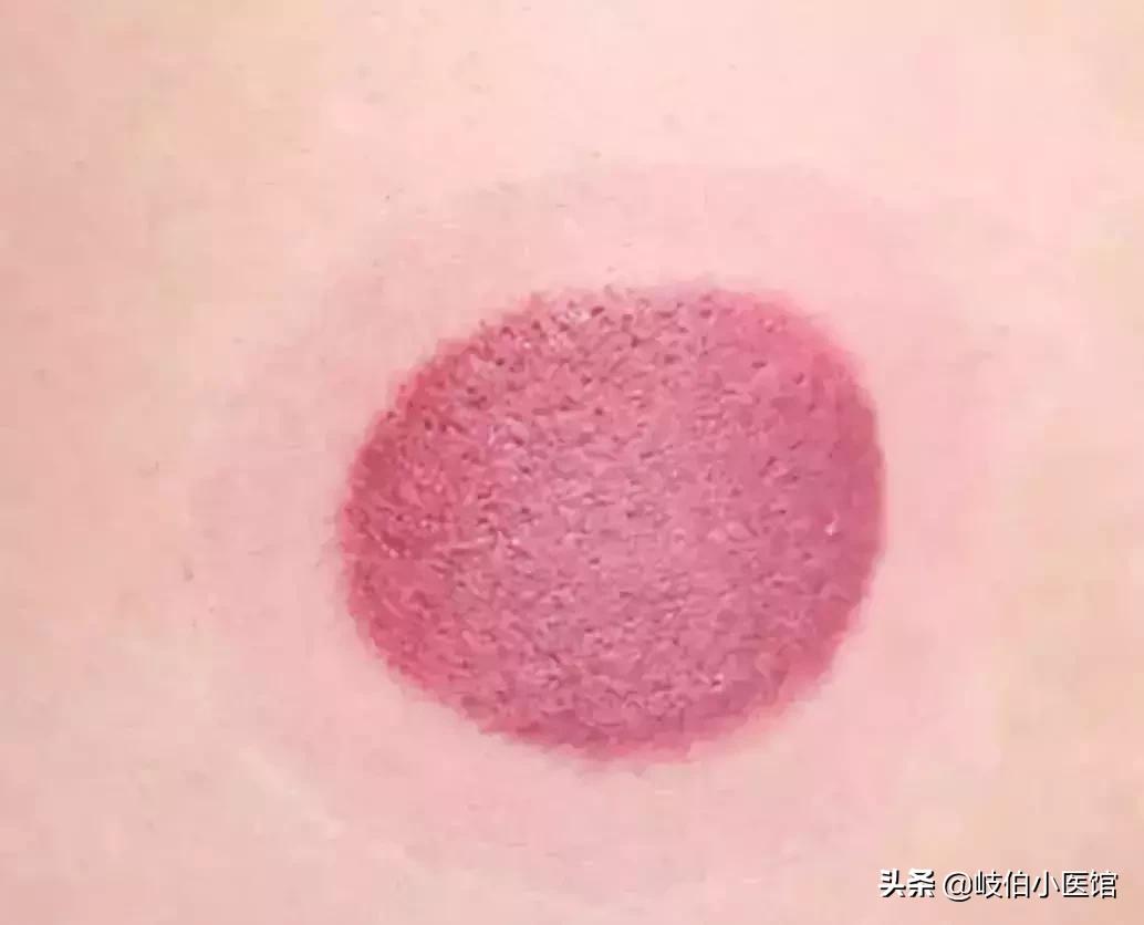 中医火罐疗法有哪些注意事项,中医火罐穴位图