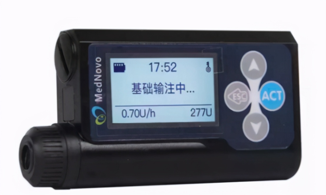 优泵胰岛素泵最新价格,德国胰岛素泵品牌及价格