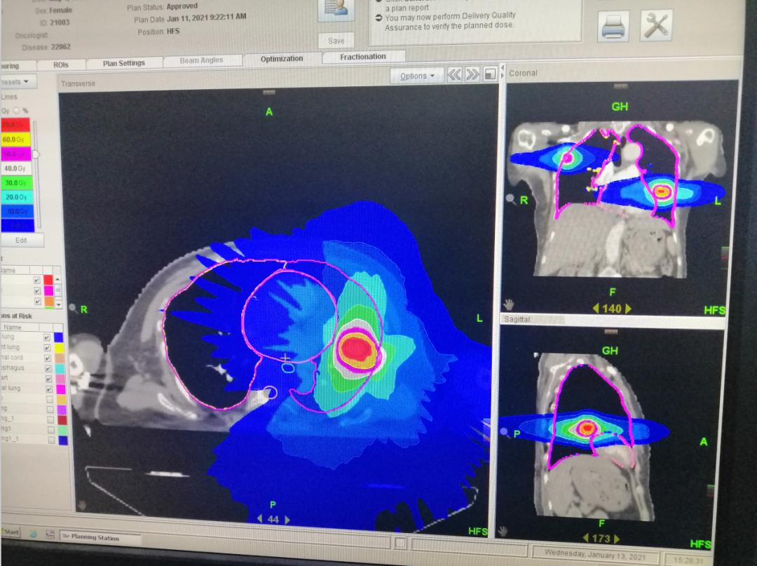 精准放疗的核心人物——物理师
