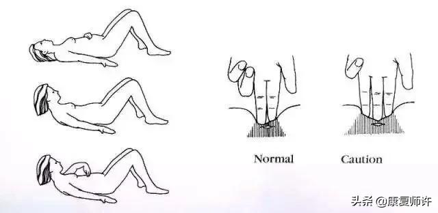 产后腹直肌分离的解决方法,产后腹直肌分离怎么处理