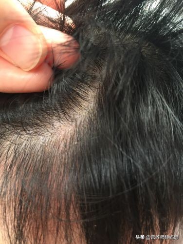 宝宝头发又少又黄要补锌吗,宝宝头发又细又黄还需要剪吗