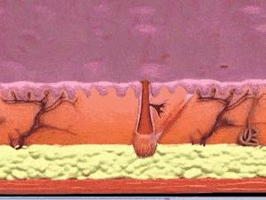 痘印痘坑真正祛除的方法,痘印痘坑去不掉怎么办