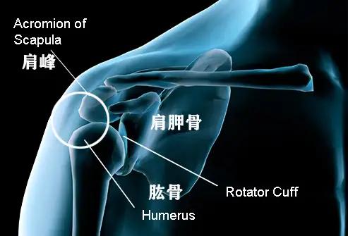 肩膀疼痛竟是如此大问题不可小觑,肩膀疼痛的辨别和解决方法