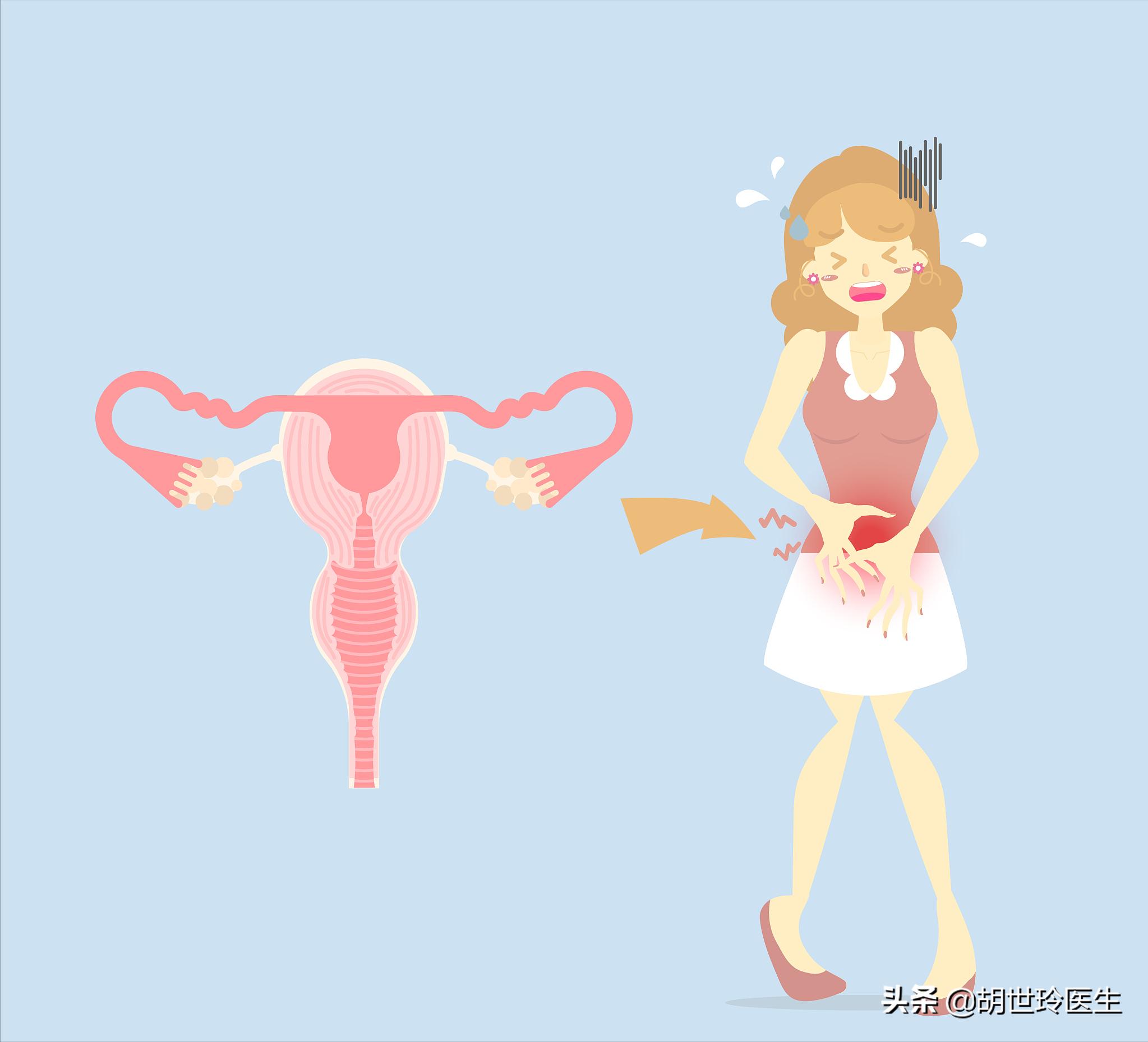 对试管的误解,对造影的常见认知误区有哪些