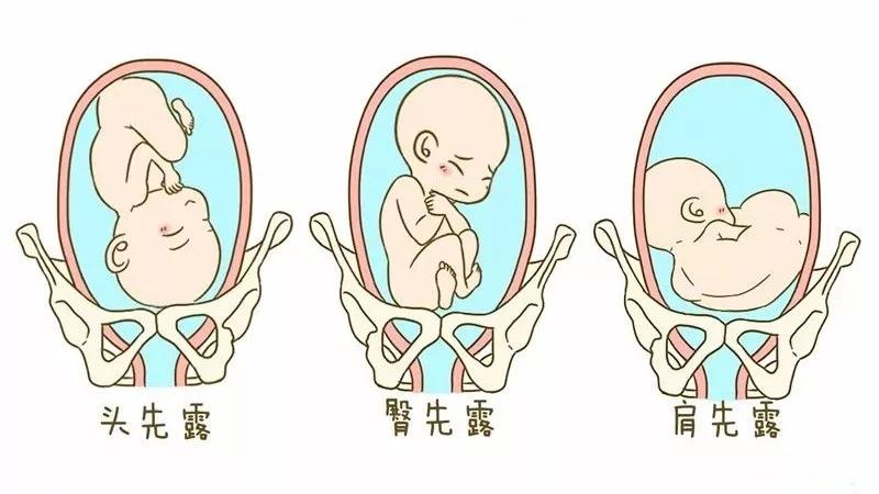 想顺产先过这4关再说,能否顺产要看什么条件