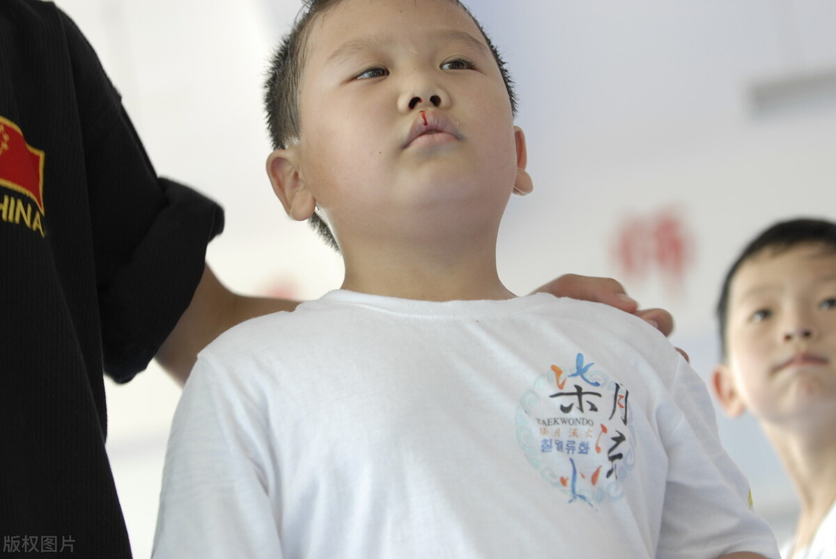 孩子有点鸡胸怎么矫正,儿童鸡胸是什么原因造成的严重吗