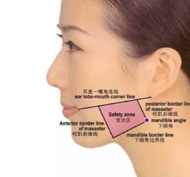 关于瘦脸针的小常识你都了解多少,瘦脸针人人都可以打吗科普篇