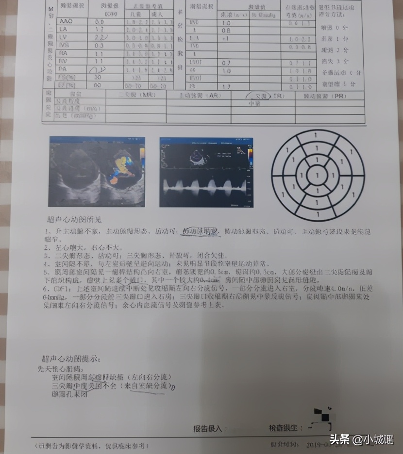 先心宝宝自愈概率,先心病宝宝经历