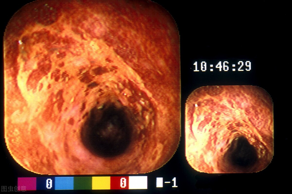 多喝烫水为啥会火,多喝烫水危害动画