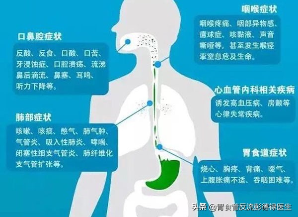 心脏大量反流会头晕胸痛吗,胸痛心悸头晕