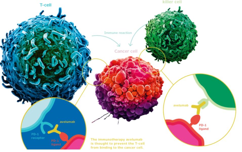 乳腺癌转移手术好还是不手术好,乳腺癌转移全切后不放疗行吗
