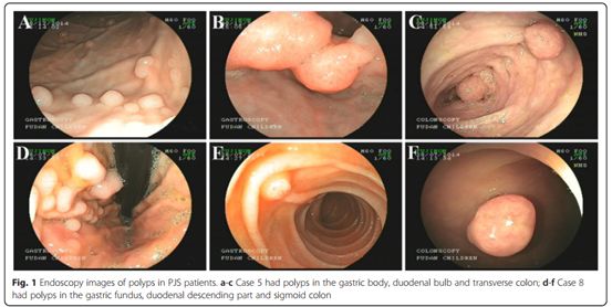 小孩嘴唇长黑斑是怎么回事,小孩嘴唇黑有什么病
