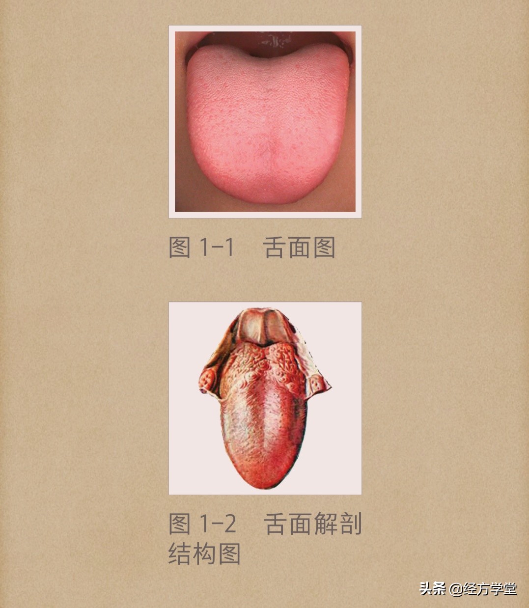 舌诊图片与经方治疗,中医舌诊系统学习
