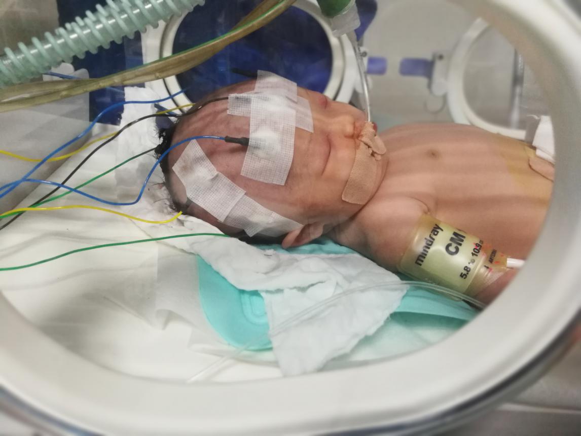 妇幼保健院nicu一天多少钱,nicu妇幼