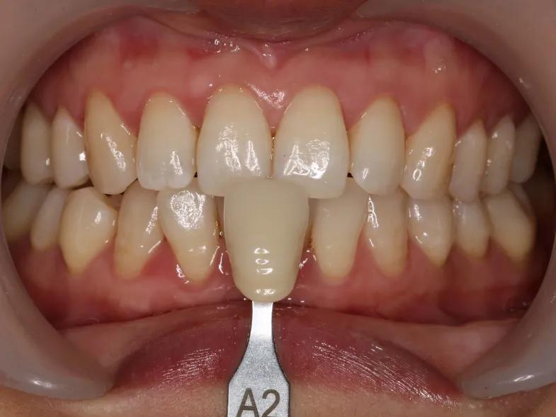 牙齿美白这个行业靠谱吗,柠檬美白牙齿靠谱吗