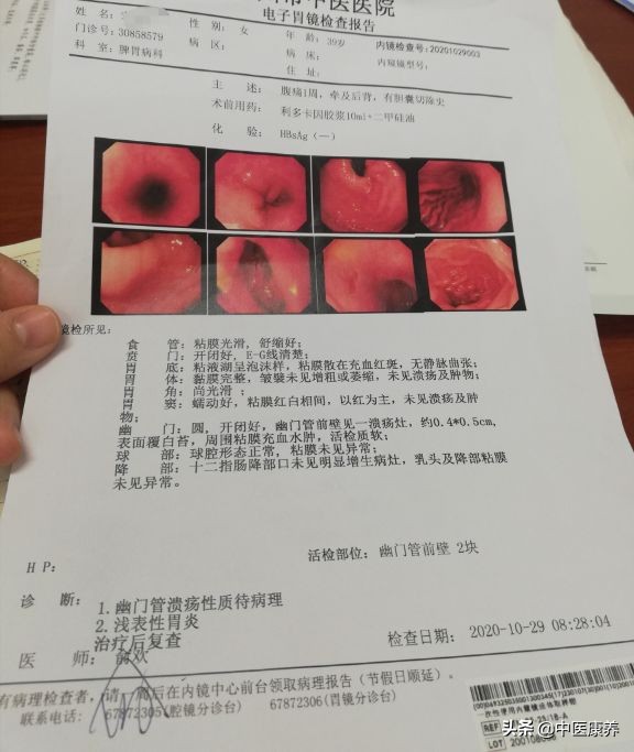 总是打嗝有什么小技巧,经常打嗝吃什么药能解决