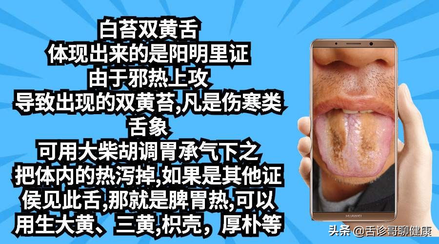 舌诊哥说亚健康,抖音舌诊哥舌象分析