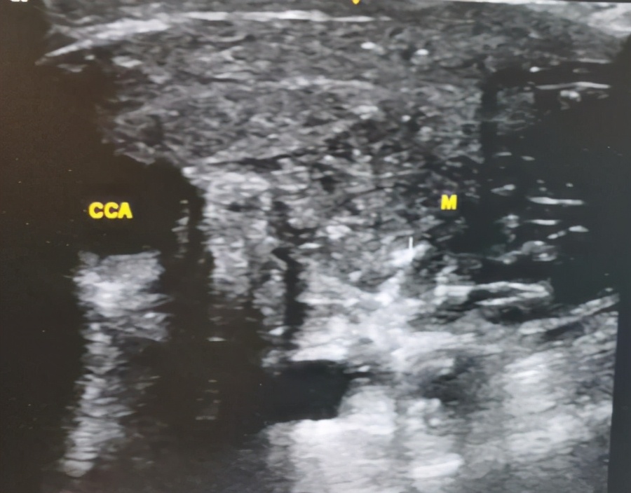 商丘→郑州，好好喘口气就这么难吗