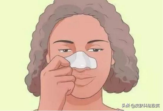 鼻子上没有黑头但是很多色素,中性皮但是鼻子好多黑头