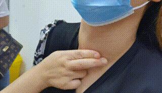 甲亢治愈的真实例子,甲亢用药过量导致甲减脖子粗