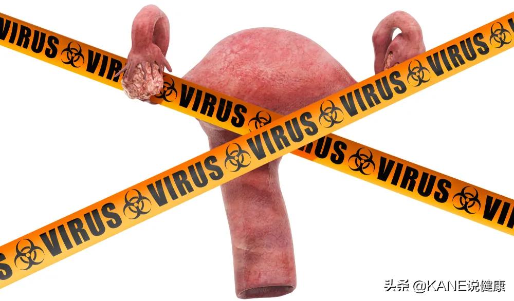 宫颈癌治疗能消灭hpv病毒吗,宫颈癌筛查hpv阳性怎么提高免疫力